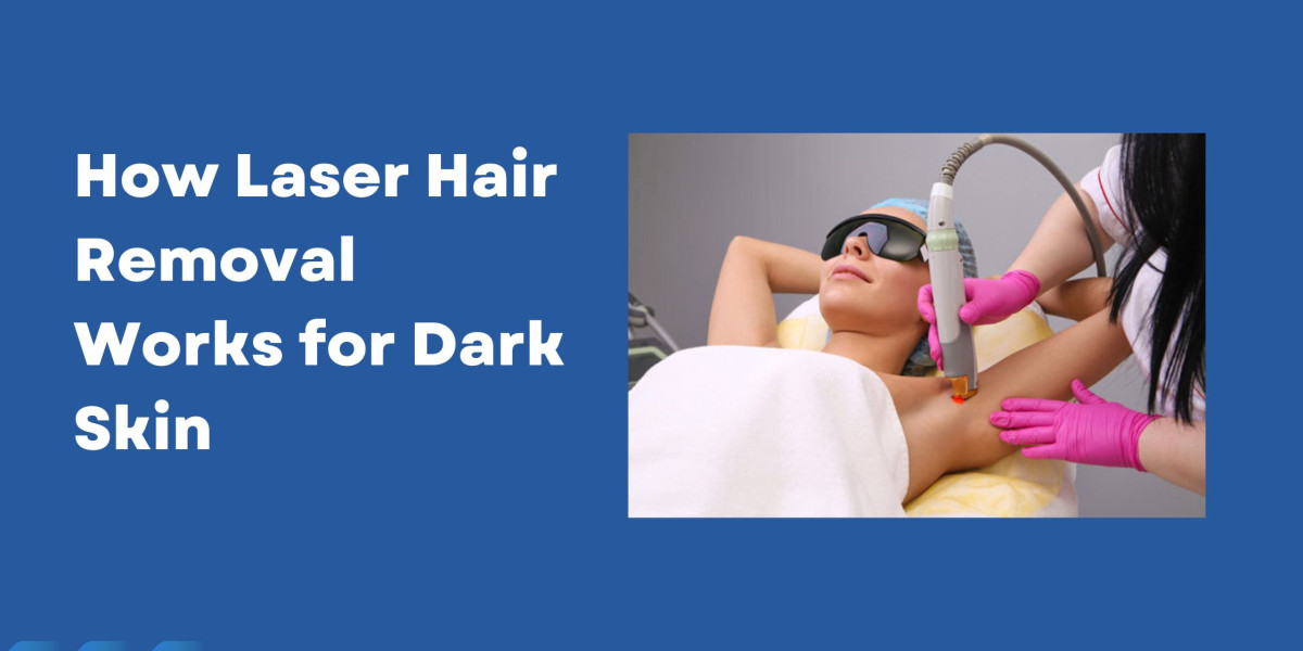 How Laser Hair Removal Works for Dark Skin?