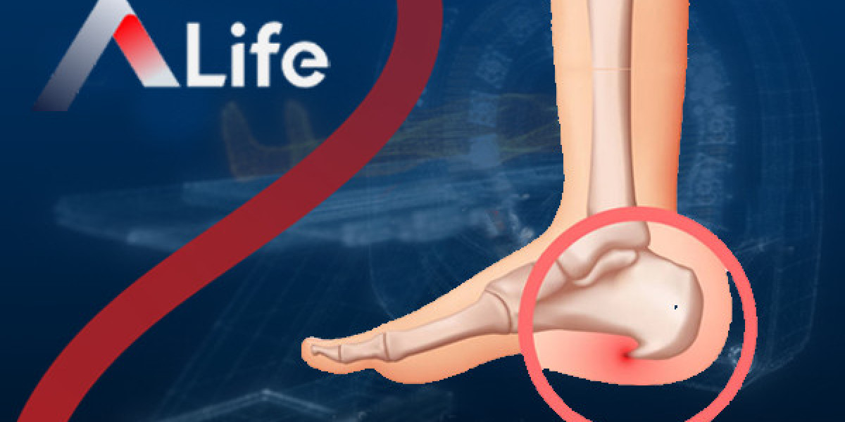 Why Heel Spurs Happen and How to Prevent Them