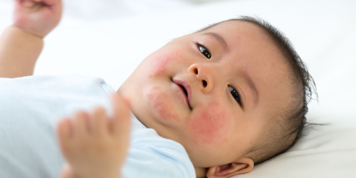 Infant Pollen Allergies: What Every Parent Needs to Know