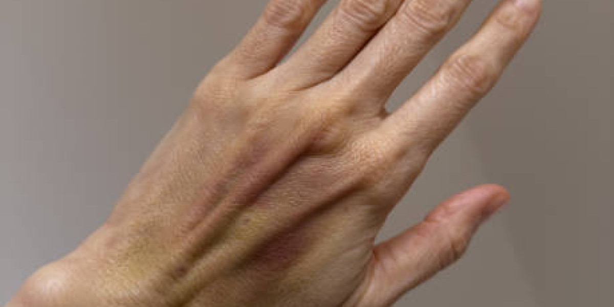 Latest Vascular Surgery Procedures Transforming Healthcare in Riyadh