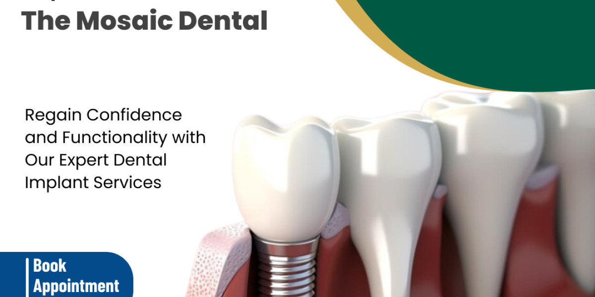 Implantologist in Hoodi Bangalore: Your Guide to Expert Dental Implant Care
