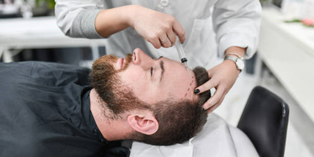 الاستمرارية في العناية بعد زراعة الشعر لضمان أفضل النتائج