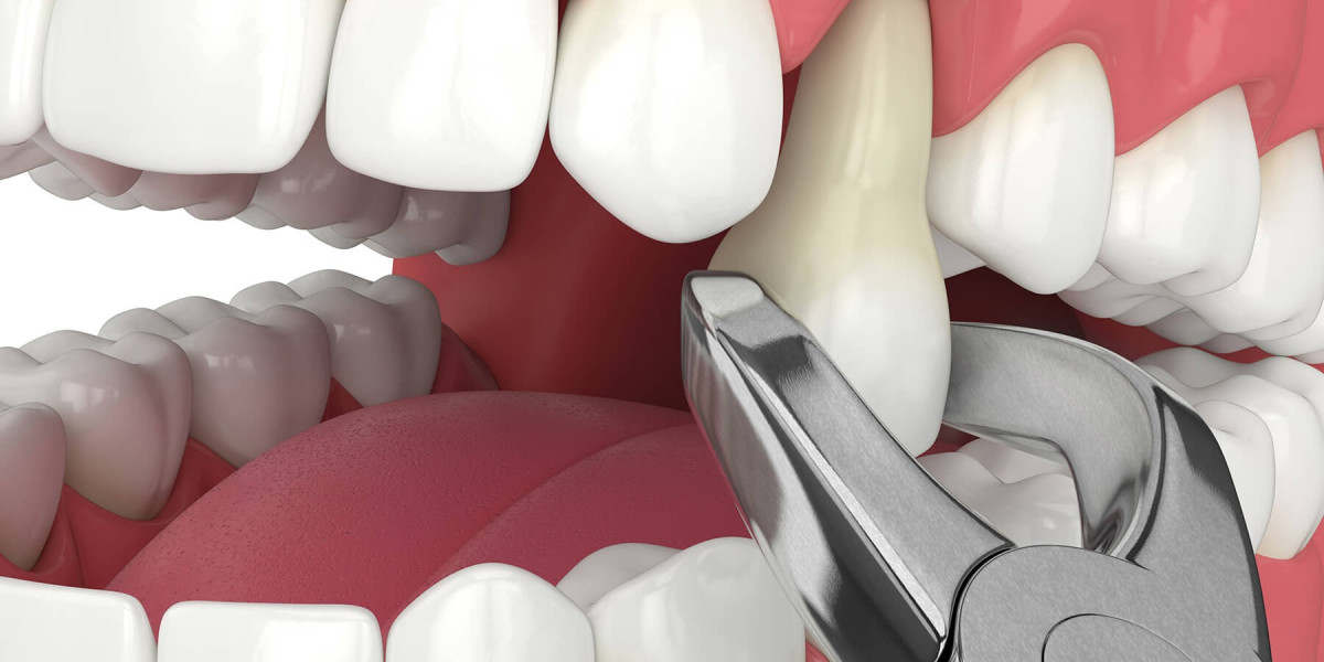 How to Check Tooth Extraction Cost in Dubai Quickly?