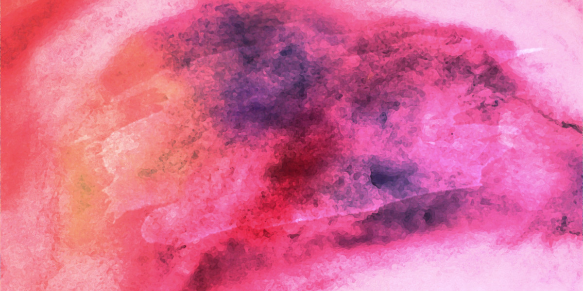 The Affect and Mechanism of Erectile Dysfunction Pills on Male Sexual Well Being