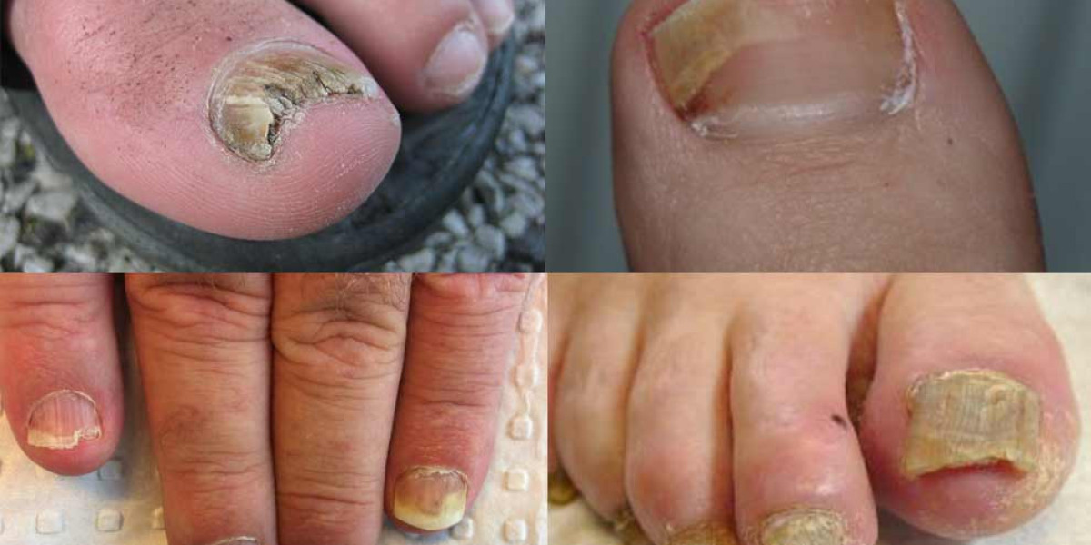 Kerassentials – The Natural Oil Formula for Healthy Nails and Skin