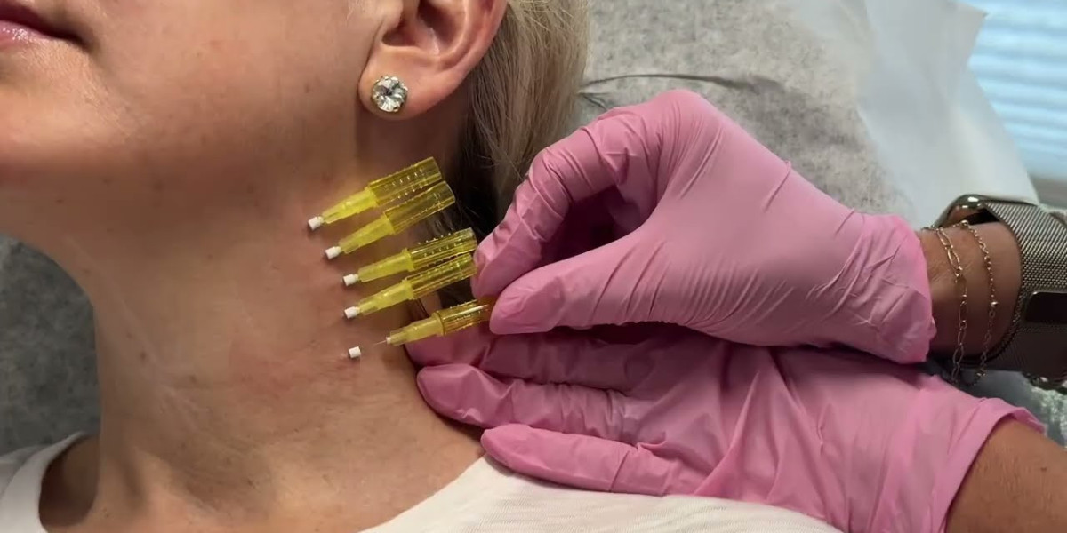 Thread Lift Treatment: Benefits, Areas Treated, and Results