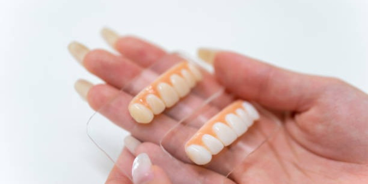 Removable Veneers: A Convenient Solution for a Perfect Smile