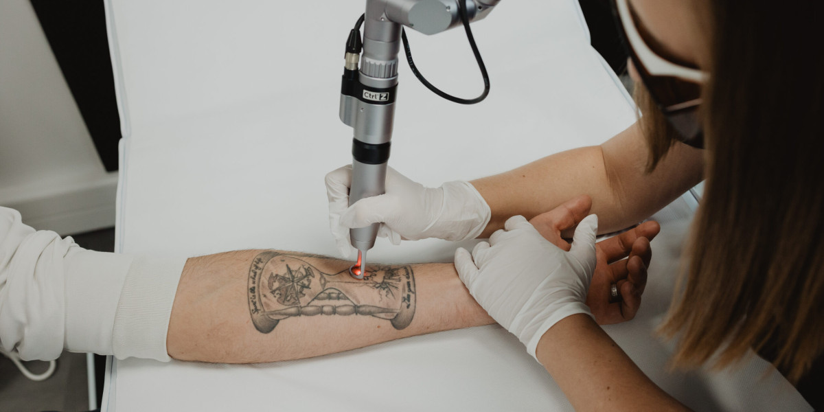 Will Laser Tattoo Removal Leave Scars?
