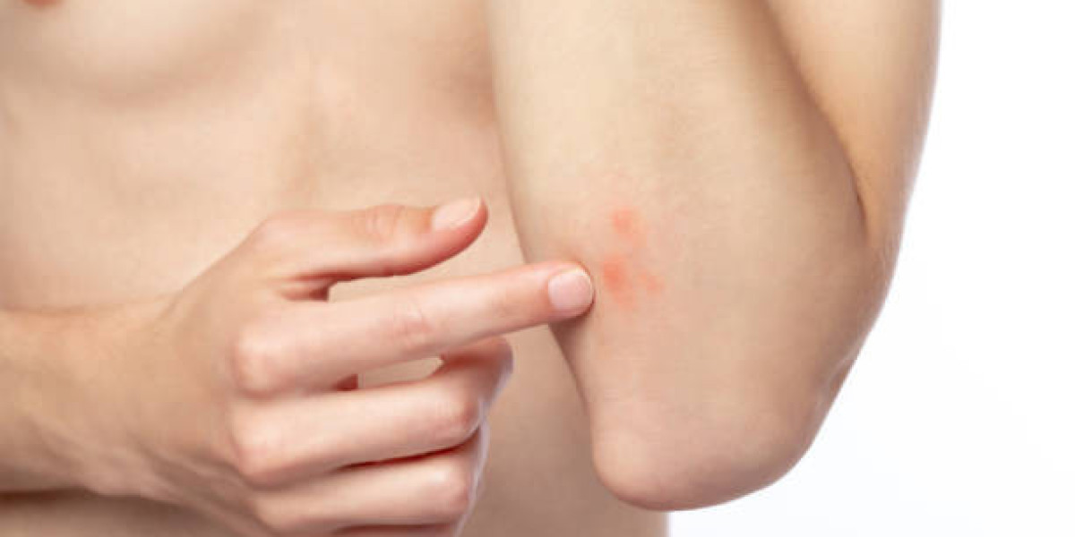 When Should You Consider Skin Lesion Removal? Key Signs to Know
