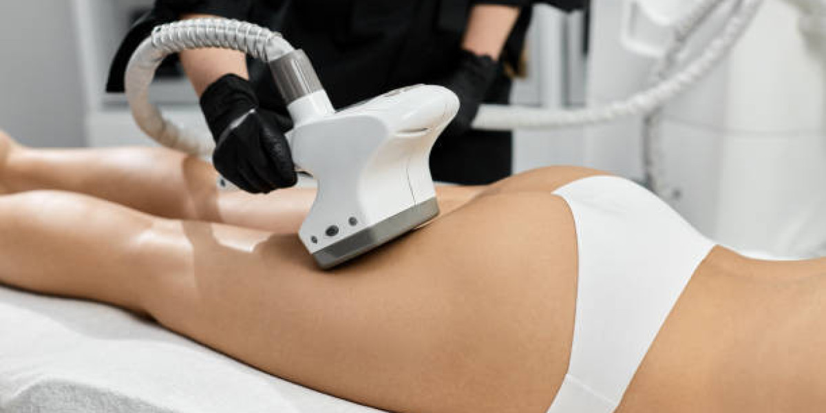 CoolSculpting Fat Freezing Recovery: What You Need to Know