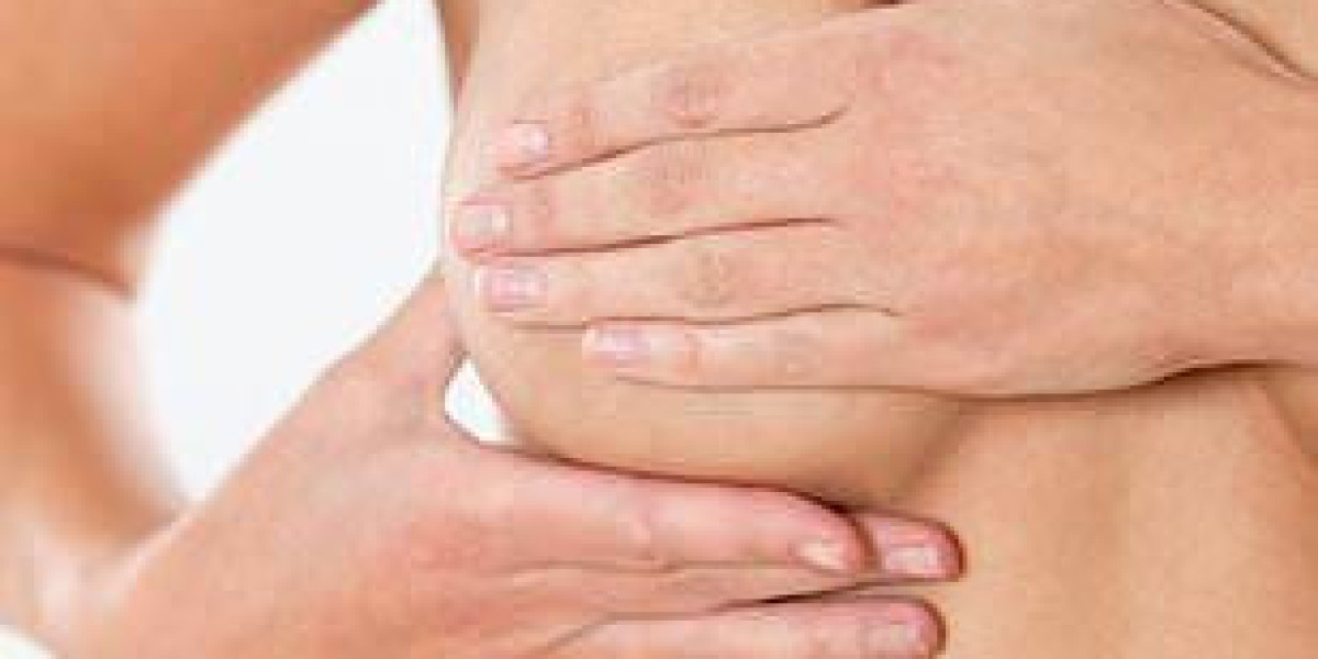 Breast Reduction Surgery and Lifestyle Changes