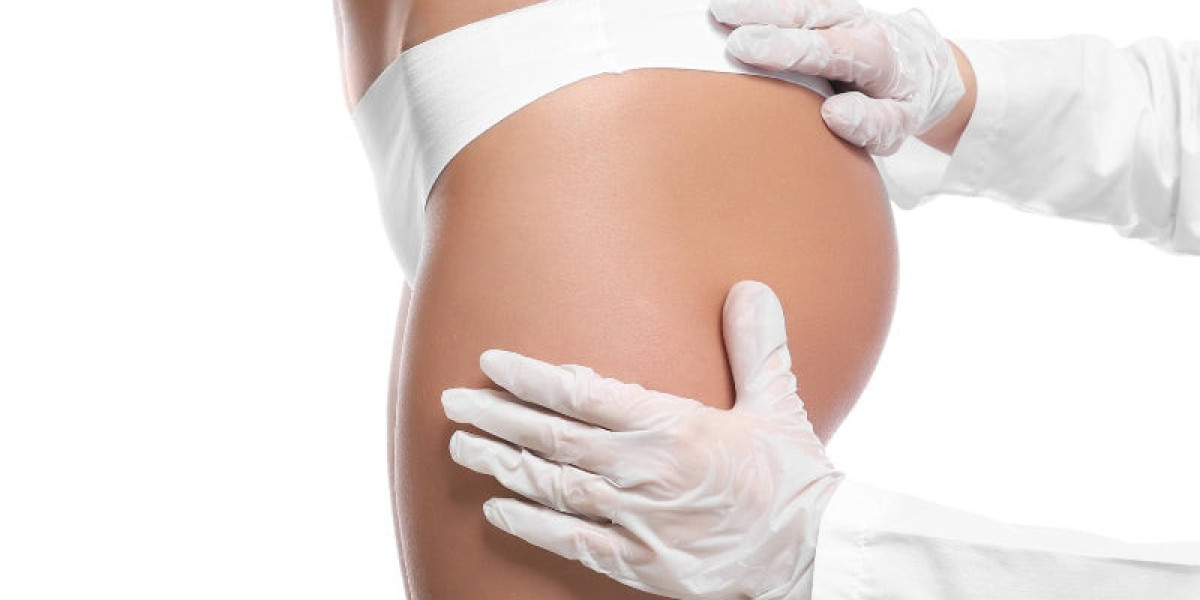 Butt & Body Fillers for Curves That Flow Smoothly and Look Balanced