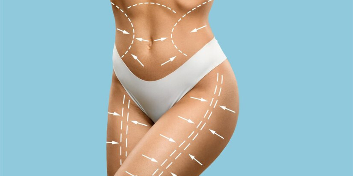 Tummy Tuck in Dubai to Achieve Sleek and Smooth Belly Contours