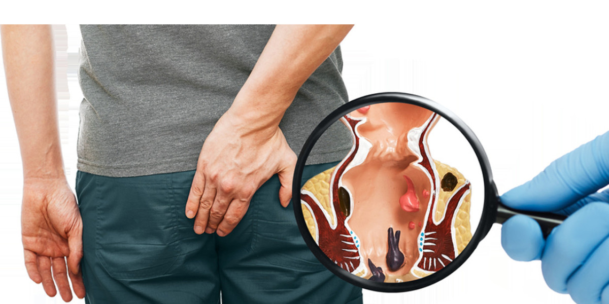 How to Choose the Best Piles Doctor in Kochi: A Complete Guide