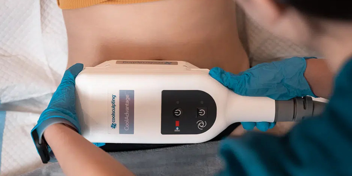 CoolSculpting Redefines Curves Without Surgery or Downtime
