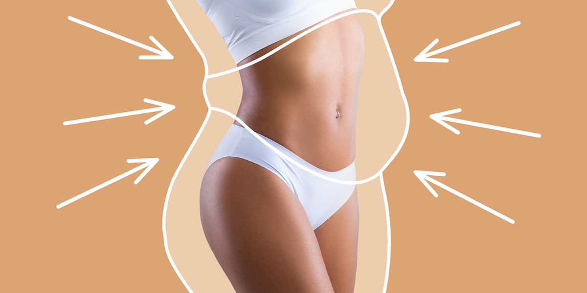Liposuction for Plus-Size Patients: What’s Possible and What’s Not
