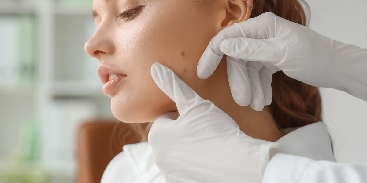 How Soon Can You Achieve Clearer Skin After Skin Tag Removal in Dubai?